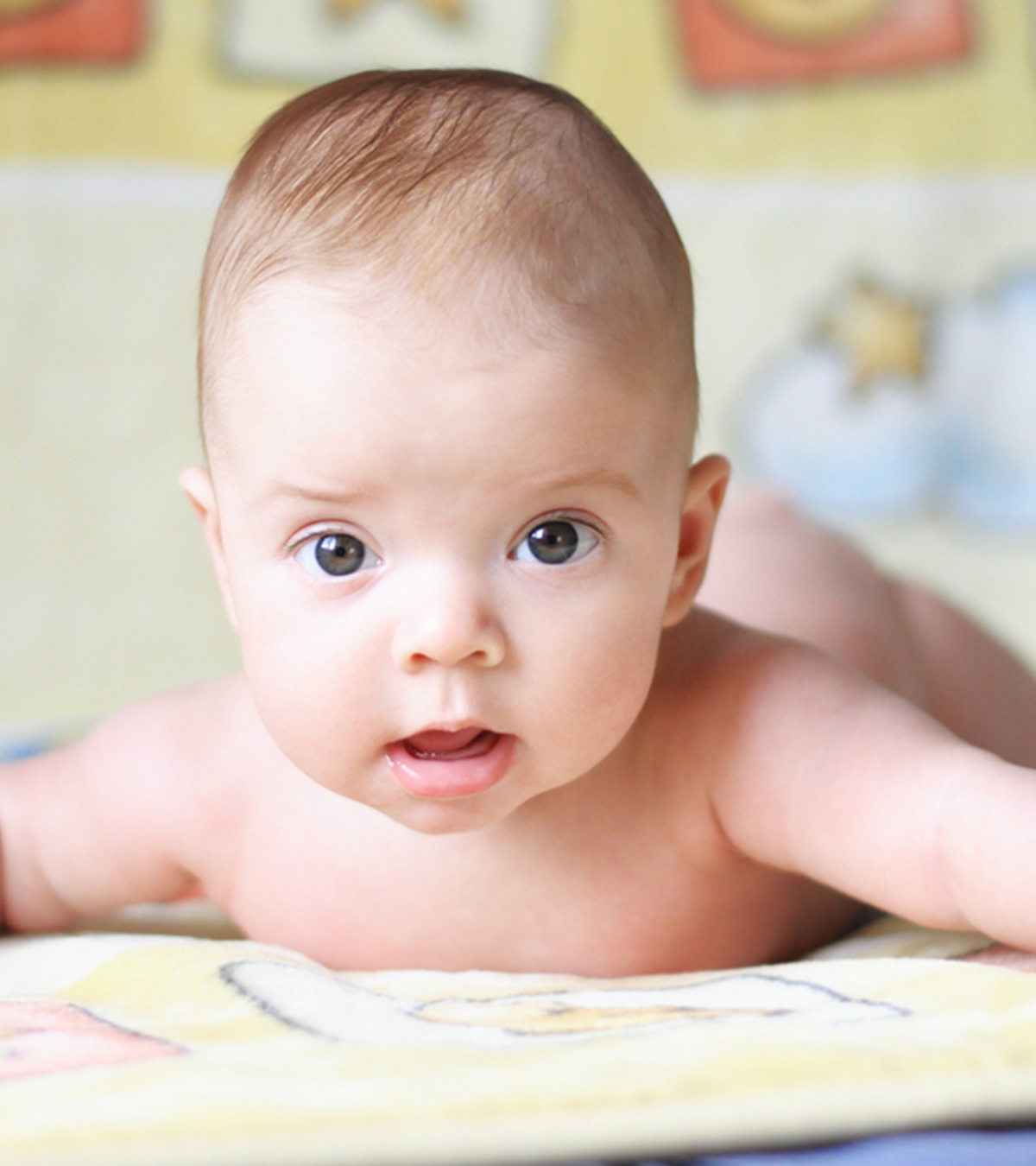 Newborn Baby With Conehead