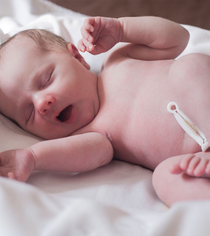 A baby with a cord clamping