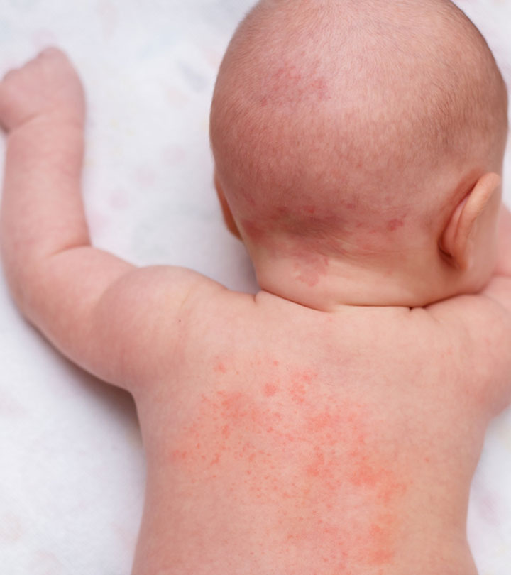 Close-up Of A Baby