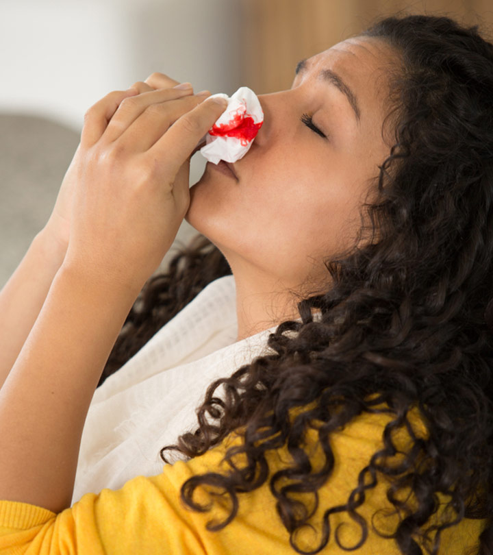 A teenage girl suffering from nose bleeding