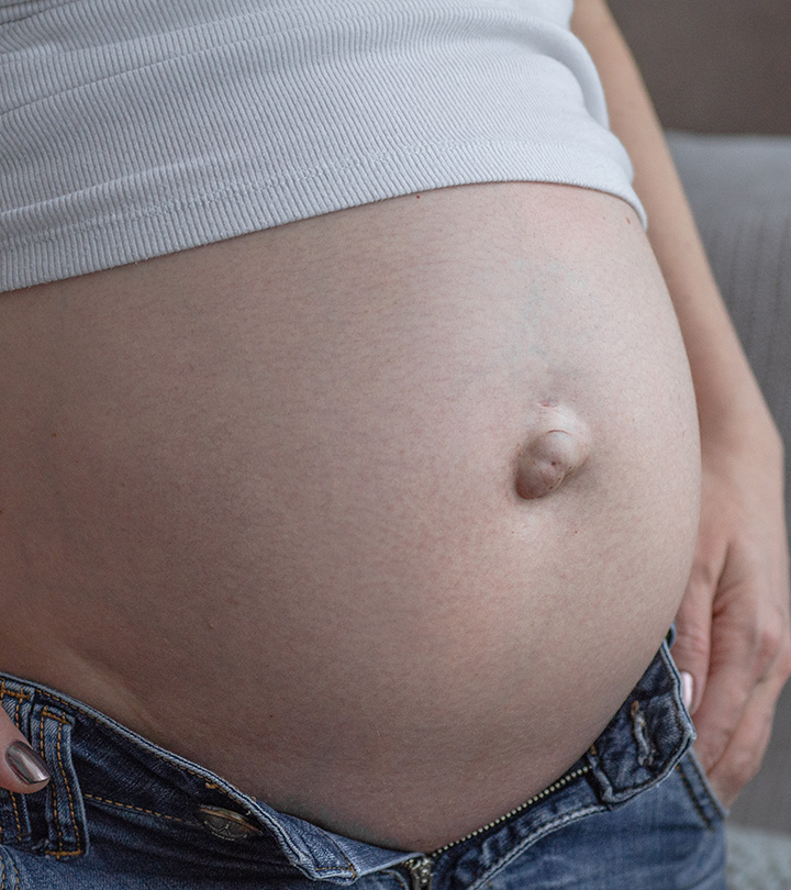 Pregnant Woman With An Umbilical Hernia